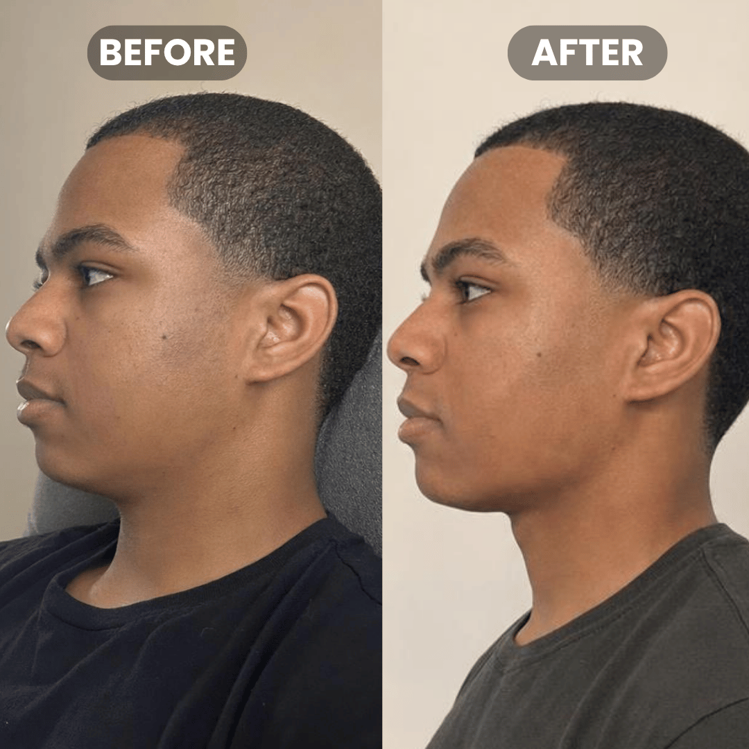 LOOKSMAXED® ULTRA TOUGH JAWLINE GUM